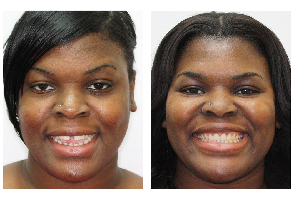 Amaya Dental