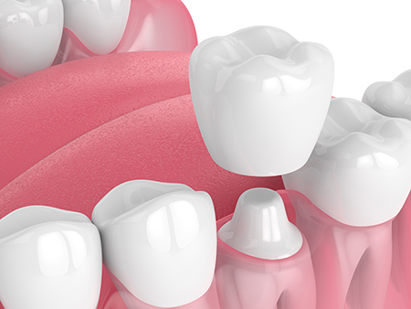 The image displays a collection of white teeth with pink gums against a red background, resembling a toothpaste tube or dental product advertisement.