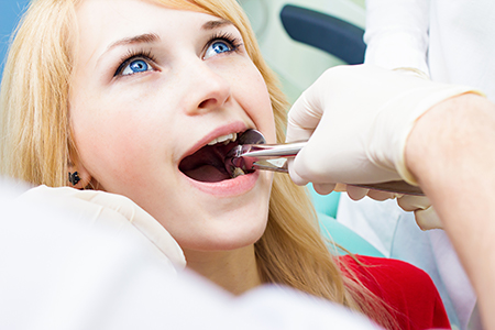 A young woman receiving dental care with her mouth open while sitting in a dental chair.