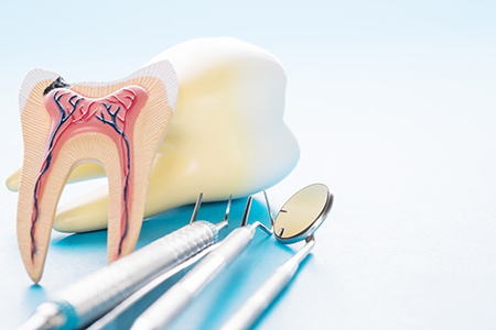 The image displays two views of a dental model with teeth missing, accompanied by dental tools such as a scalpel and tweezers, set against a blue background.